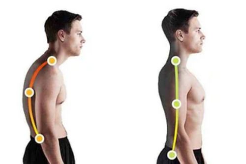 Eksilmeyen Kas Ağrılarının Sebebi: “Duruşumuz”